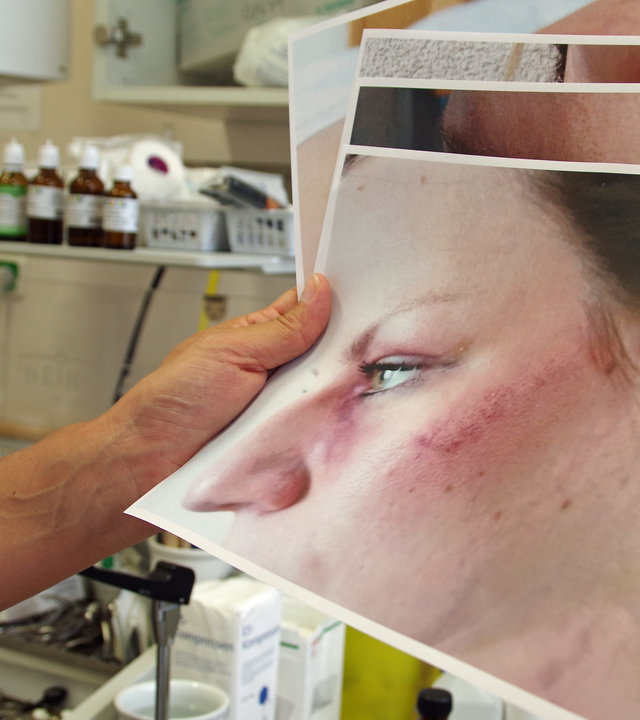 "plan b: Hinsehen und handeln - Gewalt gegen Frauen verhindern": Jemand in weißem Kittel hält Foto mit einer im Gesicht verletzten Frau drauf in der Hand.