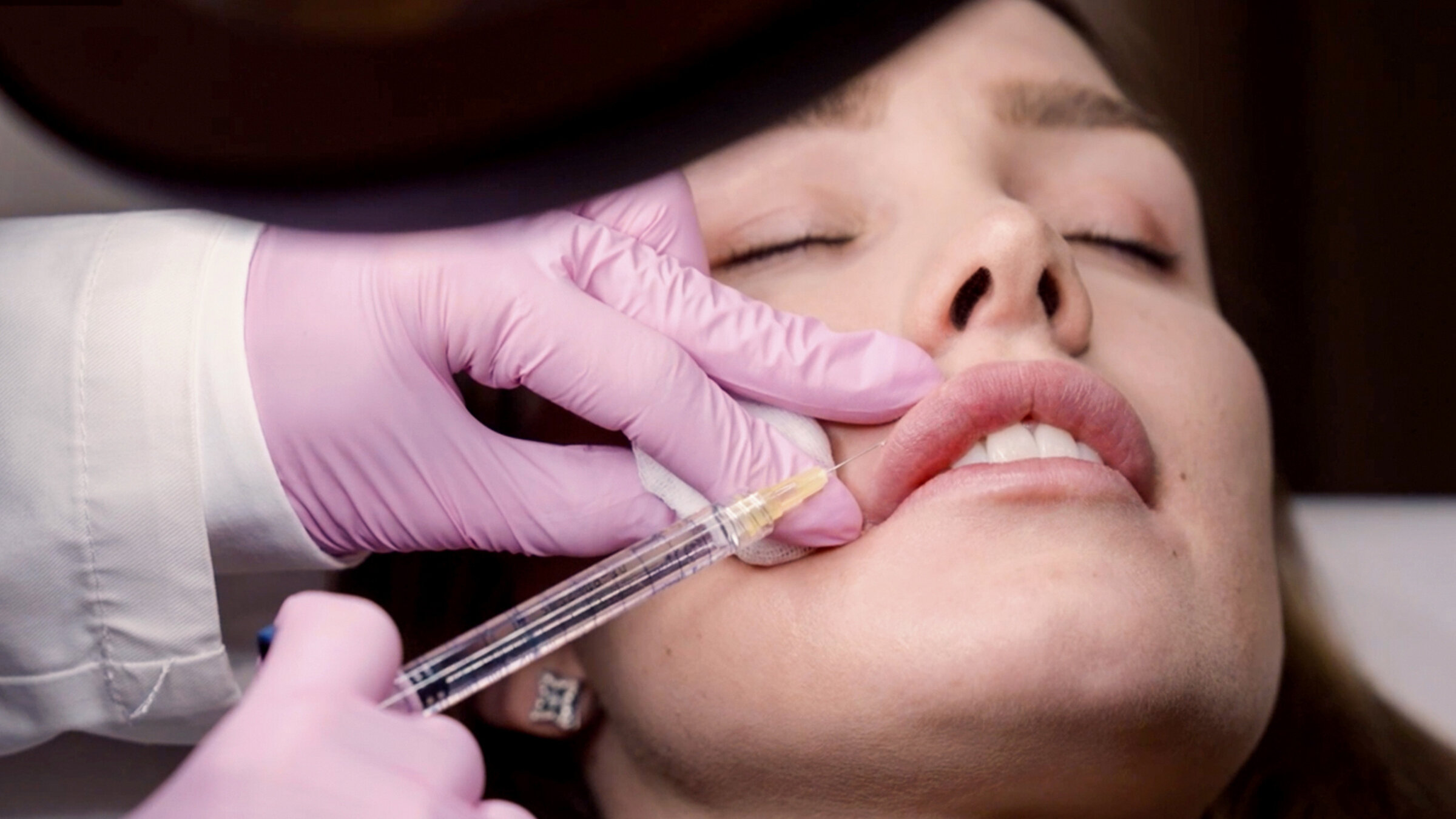 "Alles für die Schönheit – Perfektion dank Spritze": Aufgrund eines Unfalls muss sich Estelle regelmäßig die Lippen aufspritzen lassen.