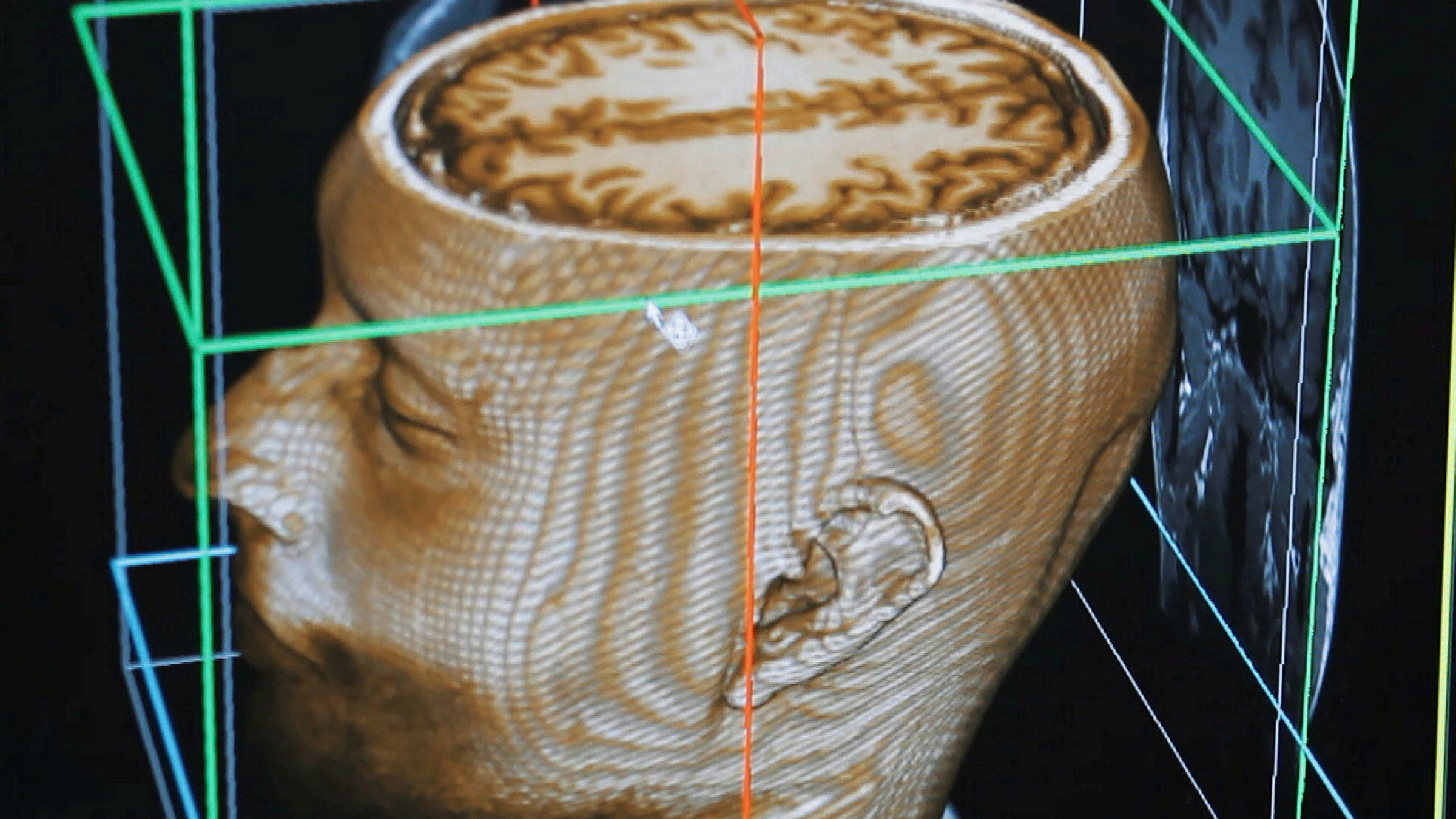 "Die Lüge – Ein Phänomen mit vielen Gesichtern": Illustration Gehirn